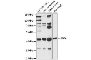 Western blot analysis of extracts of various cell lines, using SDF4 antibody (ABIN6290972) at 1:1000 dilution. (SDF4 Antikörper)