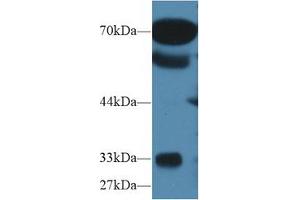 Western blot analysis of Human Serum, using Human OS9 Antibody (1 µg/ml) and HRP-conjugated Goat Anti-Rabbit antibody ( (OS9 Antikörper  (AA 466-667))