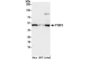 anti-Polypyrimidine Tract Binding Protein 3 (PTBP3) (AA 150-200) antibody