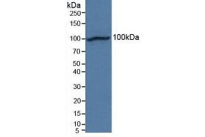 Detection of NCAD in Human Hela Cells using Polyclonal Antibody to N-cadherin (NCAD)