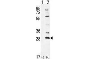 Western blot analysis of TSSK4 (arrow) using rabbit polyclonal TSSK4 Antibody (C-term) . (TSSK4 Antikörper  (C-Term))