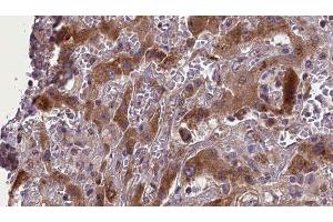 Immunohistochemistry (IHC) image for anti-Endoglin (ENG) (C-Term) antibody (ABIN6261533)