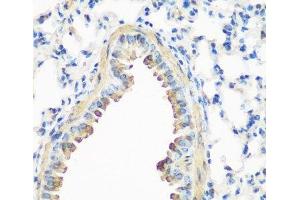 Immunohistochemistry of paraffin-embedded Mouse lung using CAV3 Polyclonal Antibody at dilution of 1:200 (40x lens). (Caveolin 3 Antikörper)