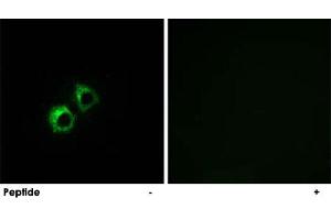 Immunofluorescence analysis of MCF-7 cells, using MRPS21 polyclonal antibody . (MRPS21 Antikörper)