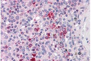 Immunohistochemistry (Formalin-fixed Paraffin-embedded Sections) (IHC (fp)) image for anti-Chaperonin Containing TCP1, Subunit 2 (Beta) (CCT2) (AA 277-473) antibody (ABIN604946)