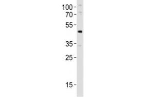 Western blot analysis of lysate from mouse pancreas tissue lysate using Pdx1 antibody at 1:1000. (PDX1 Antikörper  (AA 136-169))