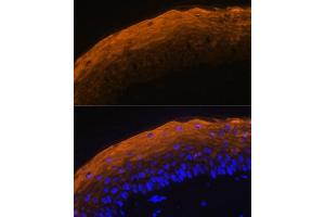 Immunofluorescence analysis of mouse skin using SPRR1A antibody (ABIN7270369) at dilution of 1:100. (SPRR1A Antikörper)