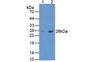 Figure. (MBL2 Antikörper  (AA 130-248))
