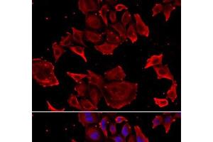Immunofluorescence analysis of HeLa cells using TCAP Polyclonal Antibody (TCAP Antikörper)