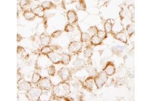 Immunohistochemistry (IHC) image for anti-Insulin Receptor Substrate 2 (IRS2) (AA 1288-1338) antibody (ABIN7448980)