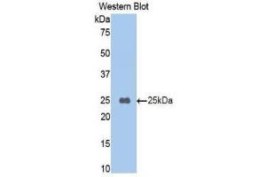 Western Blotting (WB) image for anti-Carboxypeptidase B2 (Plasma) (CPB2) (AA 187-327) antibody (ABIN1860680)