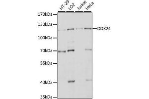 Western blot analysis of extracts of various cell lines, using DDX24 antibody.