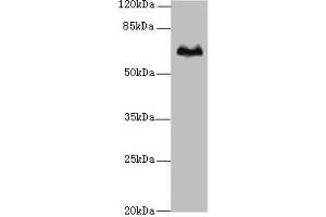 Western blot All lanes: TBX15 antibody at 5 μg/mL + Hela whole cell lysate Secondary Goat polyclonal to rabbit IgG at 1/10000 dilution Predicted band size: 66, 55 kDa Observed band size: 66 kDa (T-Box 15 Antikörper  (AA 1-496))
