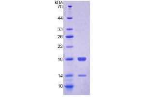 SDS-PAGE (SDS) image for Fatty Acid Binding Protein 4, Adipocyte (FABP4) (AA 1-125) protein (His tag) (ABIN6239043)