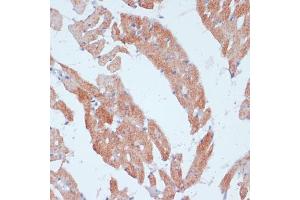 Immunohistochemistry (IHC) image for anti-Acyl-CoA Synthetase Long-Chain Family Member 3 (Acsl3) (AA 42-300) antibody (ABIN6136456)