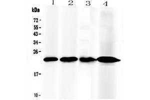 Western blot analysis of RBP4 using anti-RBP4 antibody . (RBP4 Antikörper  (AA 19-201))