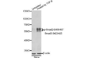 Western blot analysis of extracts of HeLa cells, using Phospho-Smad2-S465/467/-Smad3-S423/425 antibody (abx124933) at 1/1000 dilution.