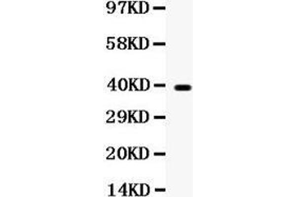 WNT7A Antikörper  (C-Term)