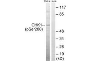 Western blot analysis of extracts from HeLa cells treated with Hu 2nM 24hours, using Chk1 (Phospho-Ser280) Antibody. (CHEK1 Antikörper  (pSer280))