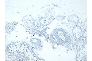 (ABIN302133) Negative Control showing staining of paraffin embedded Human Testis, with no primary antibody. (Lactate Dehydrogenase C Antikörper  (AA 221-233))