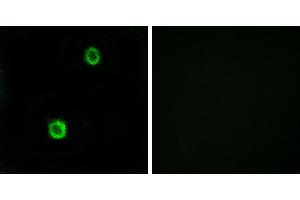 Peptide - +Immunohistochemistry analysis of paraffin-embedded human colon carcinoma tissue using CST1 antibody. (CST1 Antikörper)