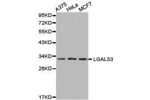 Western Blotting (WB) image for anti-Galectin 3 (LGALS3) antibody (ABIN1873541) (Galectin 3 Antikörper)