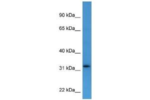 Western Blotting (WB) image for anti-Docking Protein 4 (DOK4) (C-Term) antibody (ABIN2788378) (DOK4 Antikörper  (C-Term))