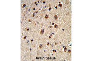 Immunohistochemistry (Paraffin-embedded Sections) (IHC (p)) image for anti-Adrenergic, Beta, Receptor Kinase 2 (ADRBK2) (AA 36-65), (N-Term) antibody (ABIN950649)