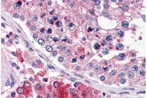 Human Testis (formalin-fixed, paraffin-embedded) stained with TMC6 antibody ABIN343905 at 5 ug/ml followed by biotinylated goat anti-rabbit IgG secondary antibody ABIN481713, alkaline phosphatase-streptavidin and chromogen. (TMC6 Antikörper  (N-Term))