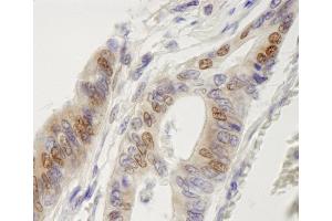Immunohistochemistry (IHC) image for anti-Interferon Regulatory Factor 3 (IRF3) (AA 100-150) antibody (ABIN7448610) (IRF3 Antikörper  (AA 100-150))
