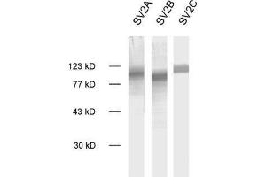 dilution: 1 : 1000, sample: crude synaptic vesicle fraction of rat brain (LP2) (SV2C Antikörper  (AA 2-16))