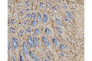 IHC analysis of EHD3 using anti-EHD3 antibody (ABIN7602777). (EHD3 Antikörper  (C-Term))