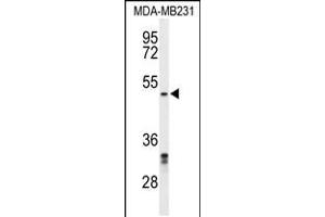 Western blot analysis of CBX2 Antibody in MDA-MB231 cell line lysates (35ug/lane) (CBX2 Antikörper  (N-Term))