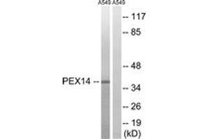 Western blot analysis of extracts from A549 cells, using PEX14 Antibody. (PEX14 Antikörper  (AA 117-166))