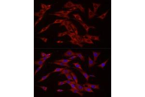 Immunofluorescence analysis of NIH/3T3 cells using cGAS Rabbit pAb (ABIN6134073, ABIN6143590, ABIN6143591 and ABIN6224360) at dilution of 1:50 (40x lens). (C6orf150 Antikörper  (AA 350-522))