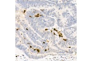 Immunohistochemistry (IHC) image for anti-Elastase, Neutrophil Expressed (ELANE) (AA 30-267) antibody (ABIN6140110)