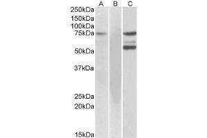 HEK293 lysate (10ug protein in RIPA buffer) overexpressing Human (ITK) with DYKDDDDK tag probed with ABIN184605 (1ug/ml) in Lane A and probed with anti-DYKDDDDK Tag (1/10000) in lane C.