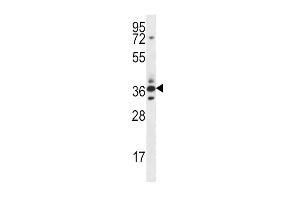 SFRP5 Antibody (Center) (ABIN656890 and ABIN2846089) western blot analysis in mouse heart tissue lysates (35 μg/lane). (SFRP5 Antikörper  (AA 190-219))