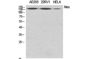 Western Blot analysis of various cells using ERBB2 Polyclonal Antibody at dilution of 1:2000. (ErbB2/Her2 Antikörper)