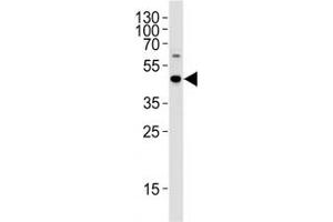 C9orf72 antibody western blot analysis in WiDr cell lysate (C9ORF72 Antikörper  (AA 396-424))