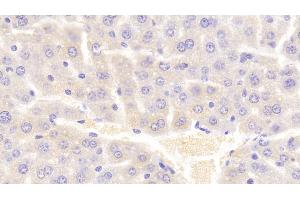 Detection of VAV1 in Mouse Liver Tissue using Polyclonal Antibody to Vav 1 Oncogene (VAV1) (VAV1 Antikörper  (AA 565-795))