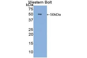 Western blot analysis of the recombinant protein. (CPE Antikörper  (AA 151-317))