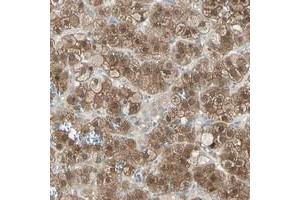 Immunohistochemical staining of human adrenal gland with LHPP polyclonal antibody  shows strong cytoplasmic positivity in cortical cells at 1:200-1:500 dilution. (LHPP Antikörper)