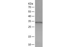 Western Blotting (WB) image for Tropomyosin 3 (TPM3) (AA 6-246) protein (His tag) (ABIN7125505) (TPM3 Protein (AA 6-246) (His tag))