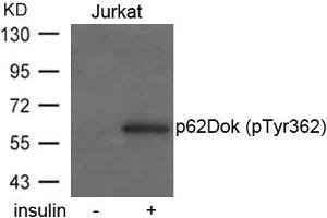 Western blot analysis of extracts from Jurkat cells untreated or treated with insulin using p62Dok(phospho-Tyr362) Antibody. (DOK1 Antikörper  (pTyr362))