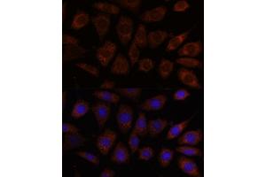 Immunofluorescence analysis of L929 cells using SEC24D antibody (ABIN7270171) at dilution of 1:100.