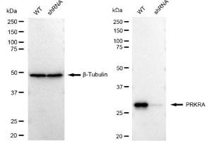 Western blotting analysis using PRKRA antibody (ABIN7800015). (Rekombinanter PRKRA Antikörper)