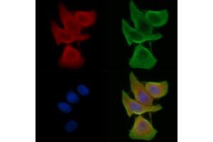 ABIN7095380 and ABIN7099437 staining Hela cells(45 min of heat-shock treatment) by IF/ICC.