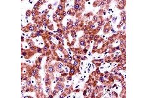 Integrin beta 5 antibody immunohistochemistry analysis in formalin fixed and paraffin embedded human liver tissue. (Integrin beta 5 Antikörper  (AA 216-244))