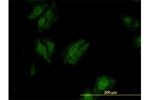 Immunofluorescence of monoclonal antibody to KSR2 on HeLa cell.